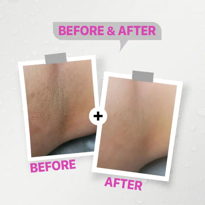 Whitening deodorant Cotton candy