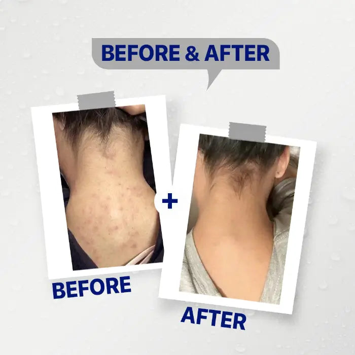 Kolanog Body Wash (200ML)