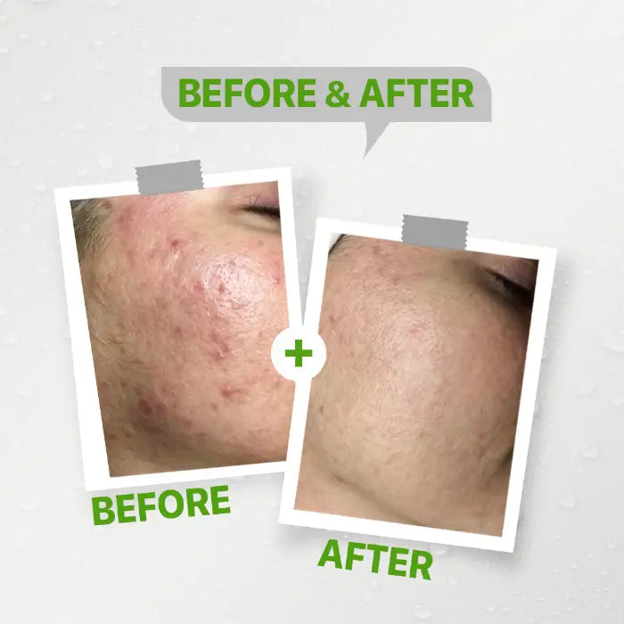 Kolanog oily facial cleanser