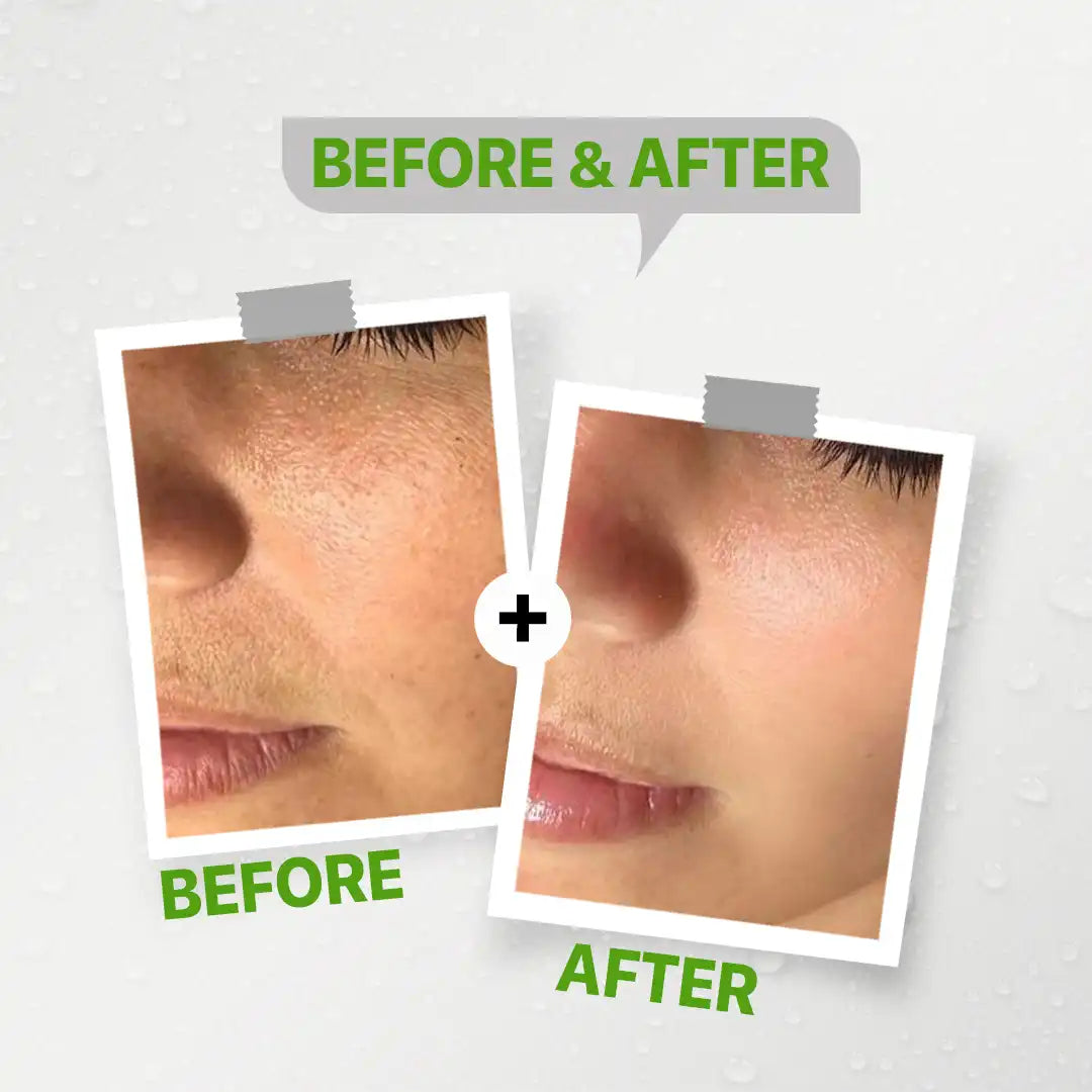 Facial Cleanser See lit