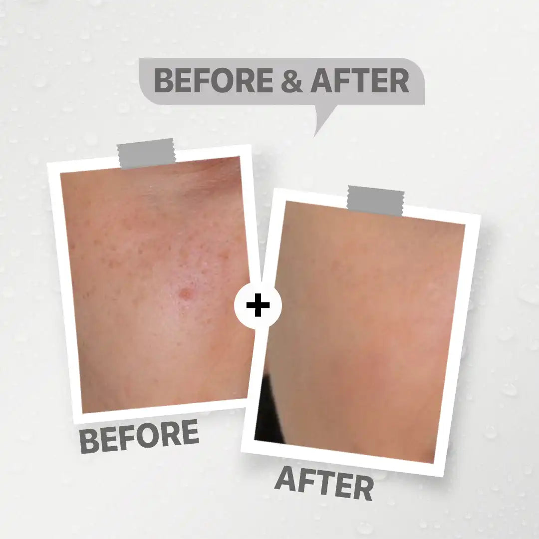 See lit advanced serum