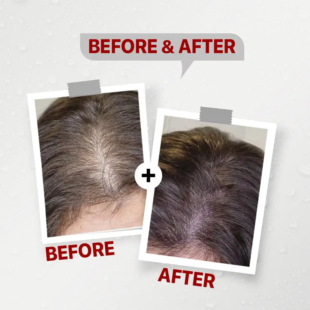 Firstvoc shampoo and conditioner