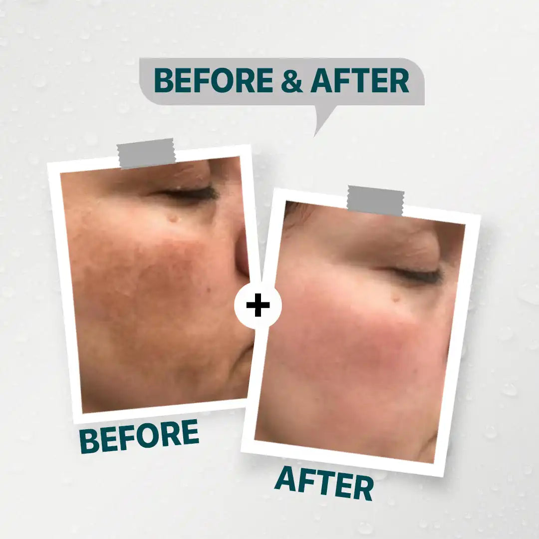 Daky night whitening cream