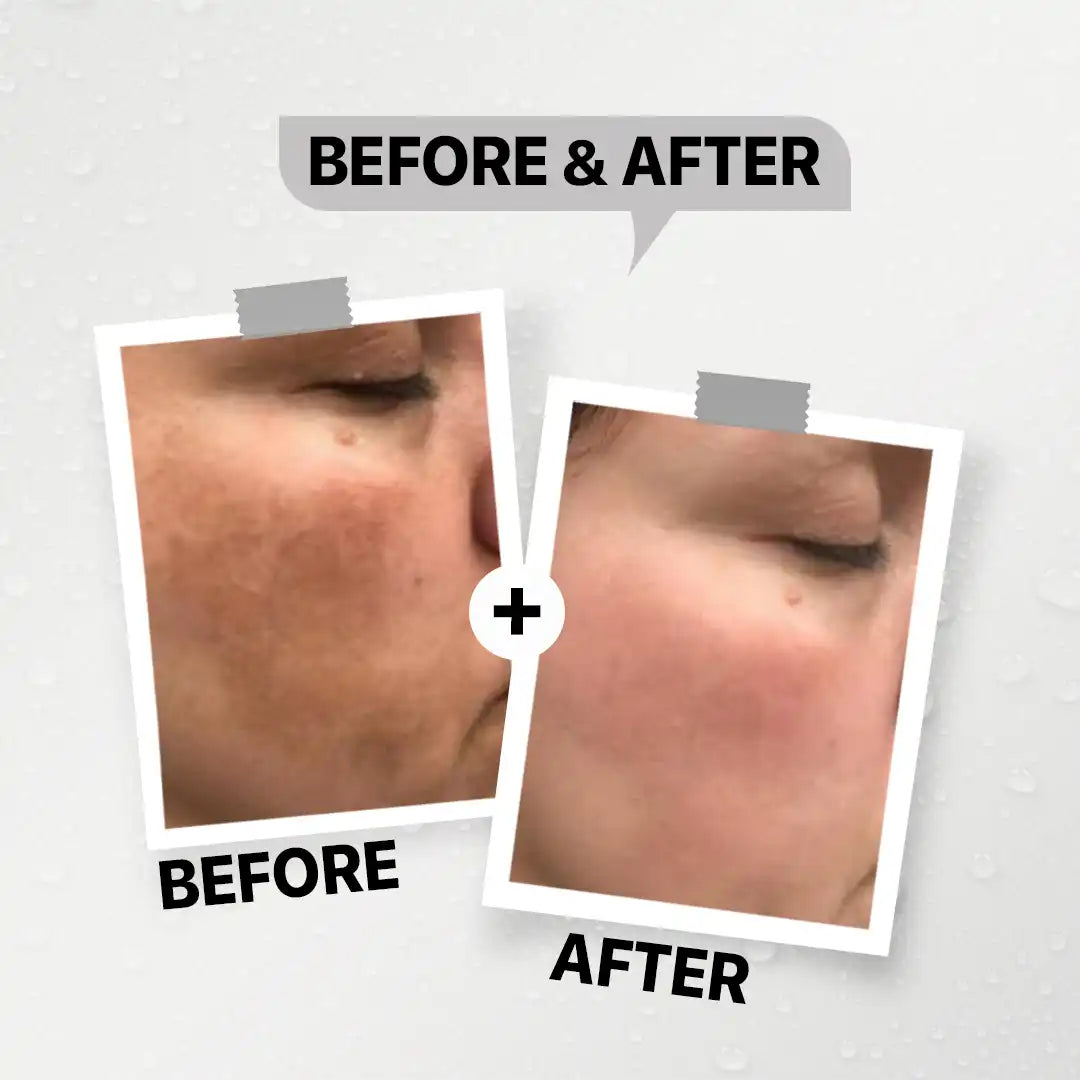 Daky Whitening Cream