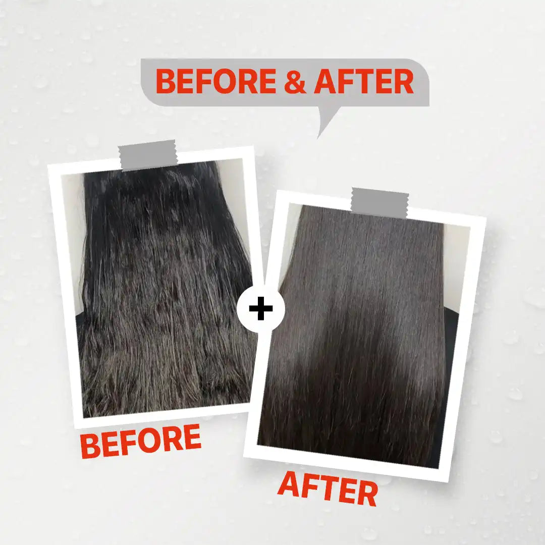 Firstvoc anti dandruff