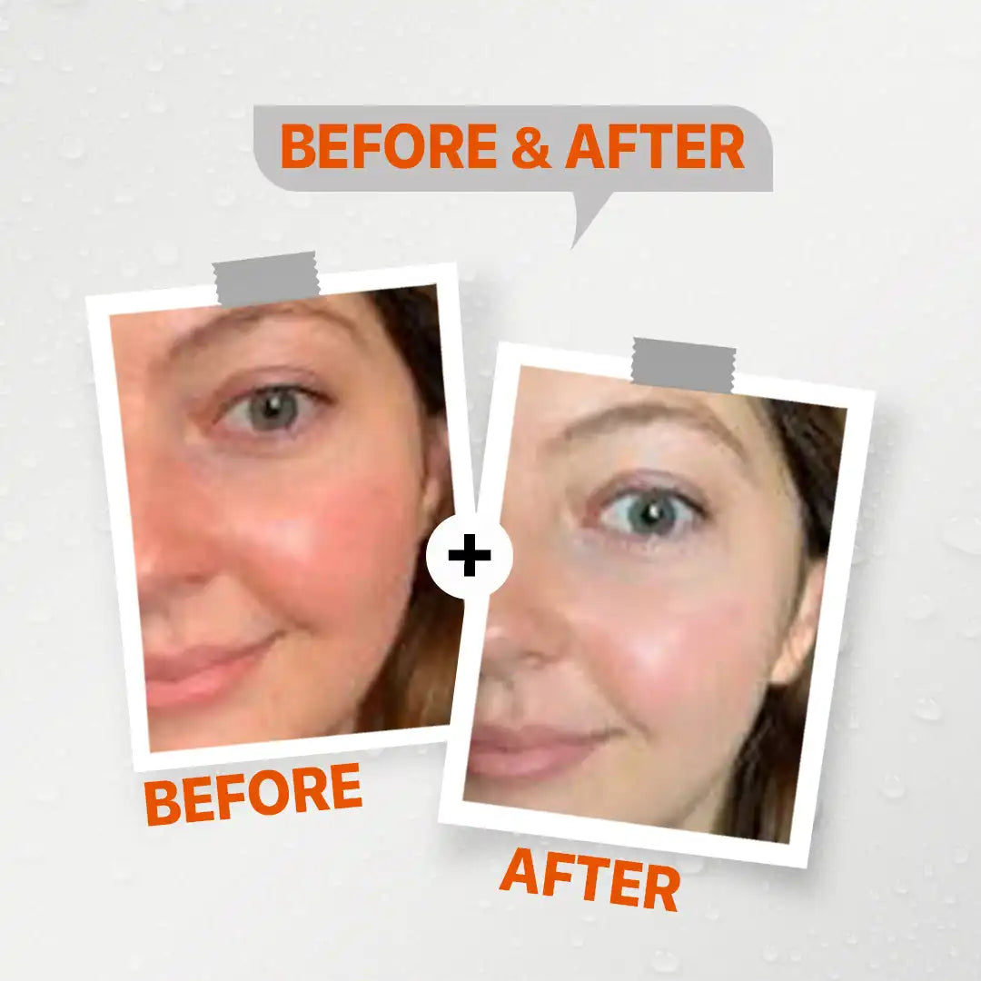 Seelit Sun Screen Lotion