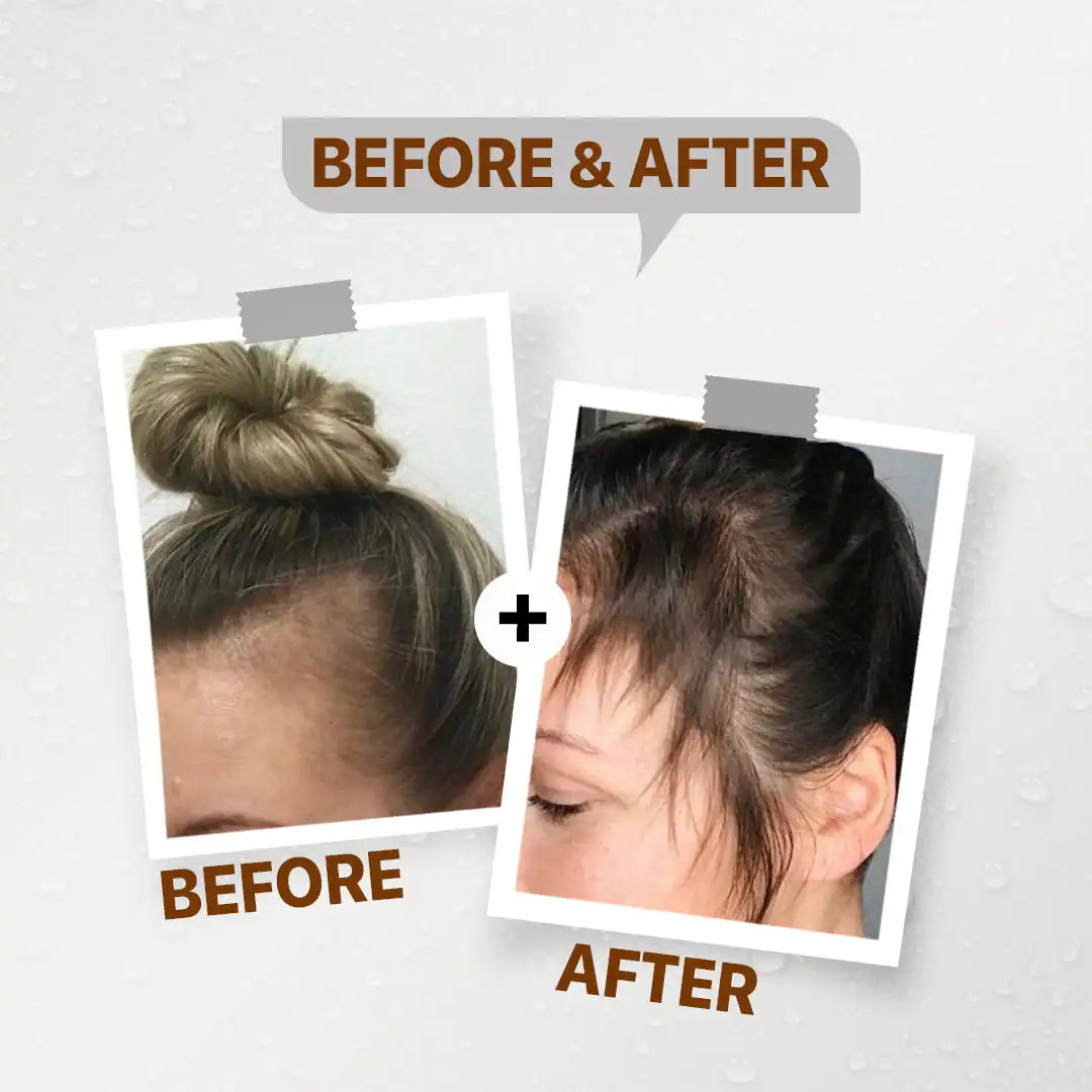 FirstVoc Anti-HairLoss Ampoules