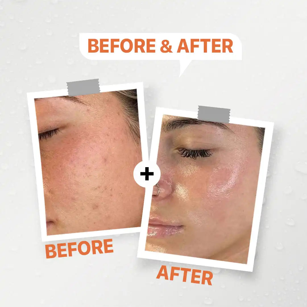 Daky Vitamin C Serum 20% (30ML)