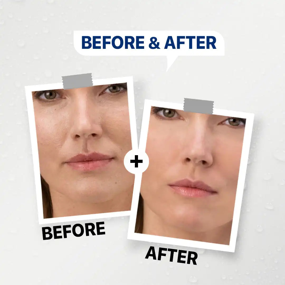 GENFX 6 PEPTIDE SKIN BOOSTER (30ml)