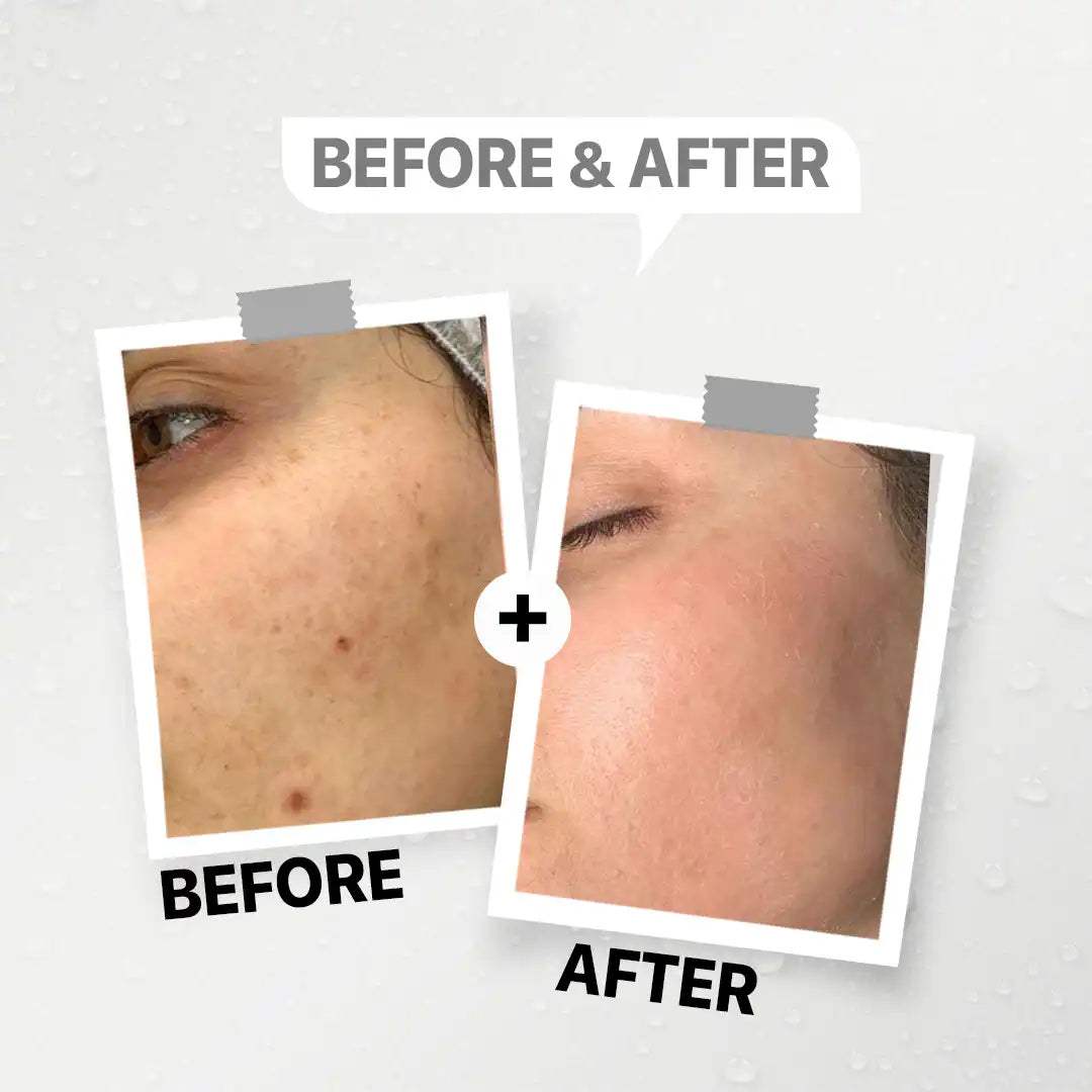 GENFX SNAIL CREAM GEL (50gm)