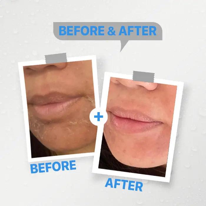 كريم جرانيا المرطب