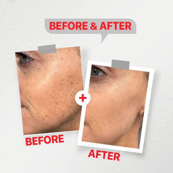 LASERO-RAY Soothing & Moisturizing