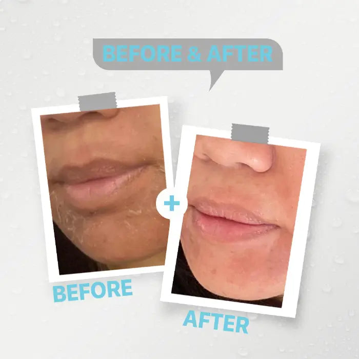 Kolanog antiaging cleanser for dry skin