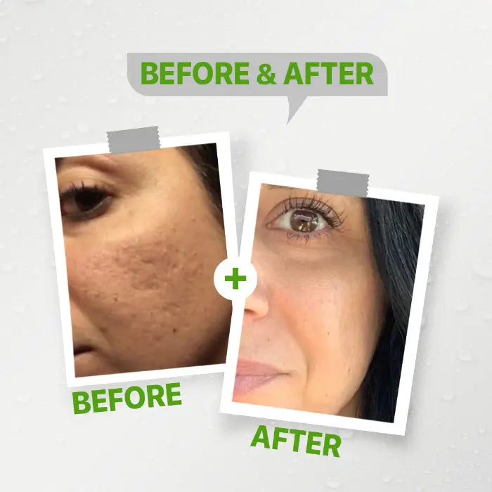 Kolanog micro-peeling foam cleanser