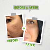 Kolanog micro-peeling foam cleanser
