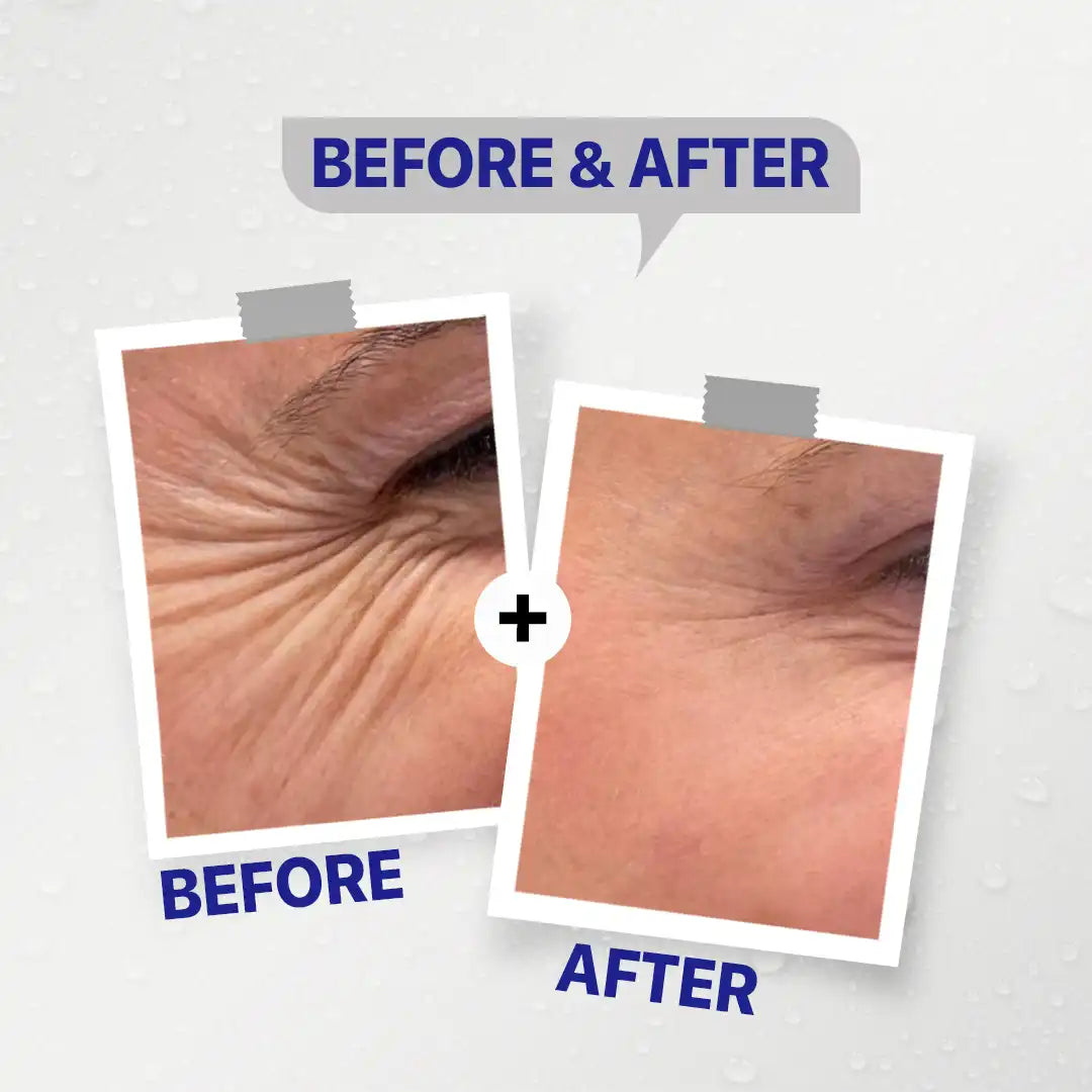 Seelit Hyaluronic