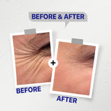 Seelit Hyaluronic