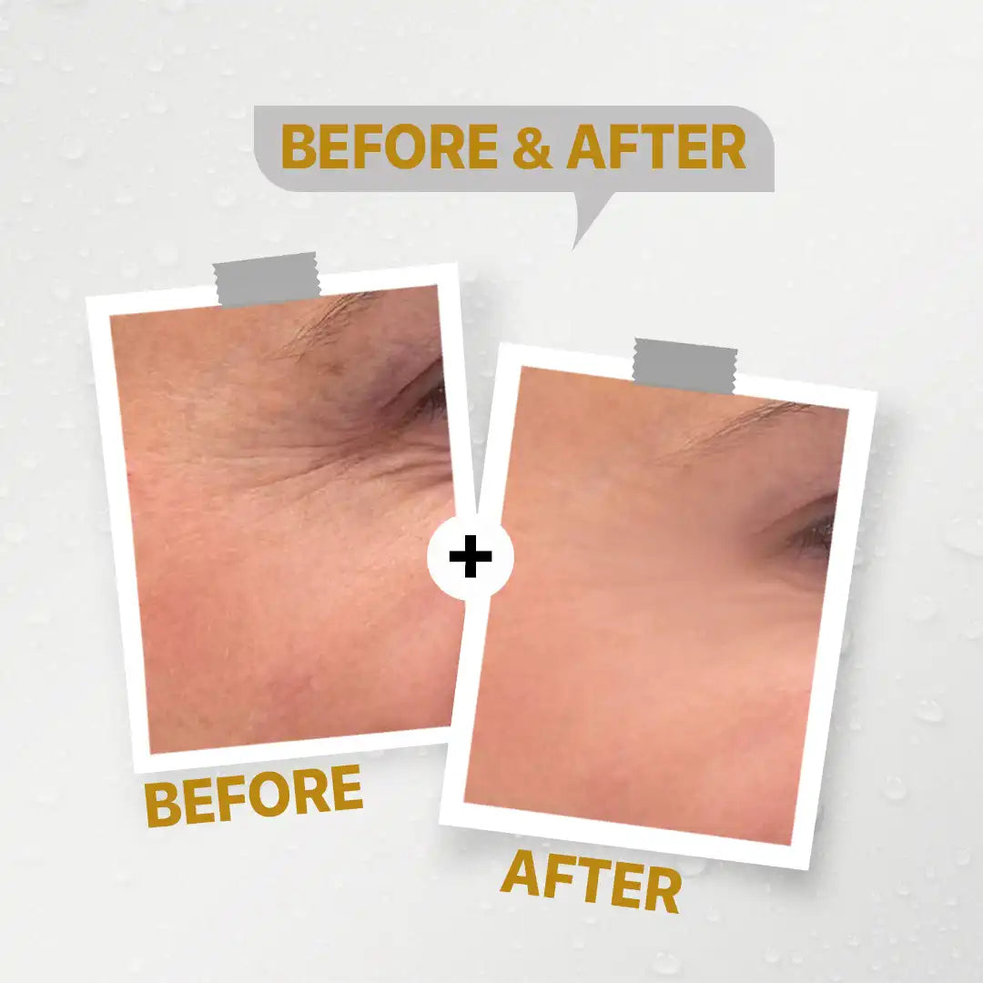 Seelit elixir argeriline,Q10 serum