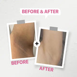 Daky sensitive whitening cream