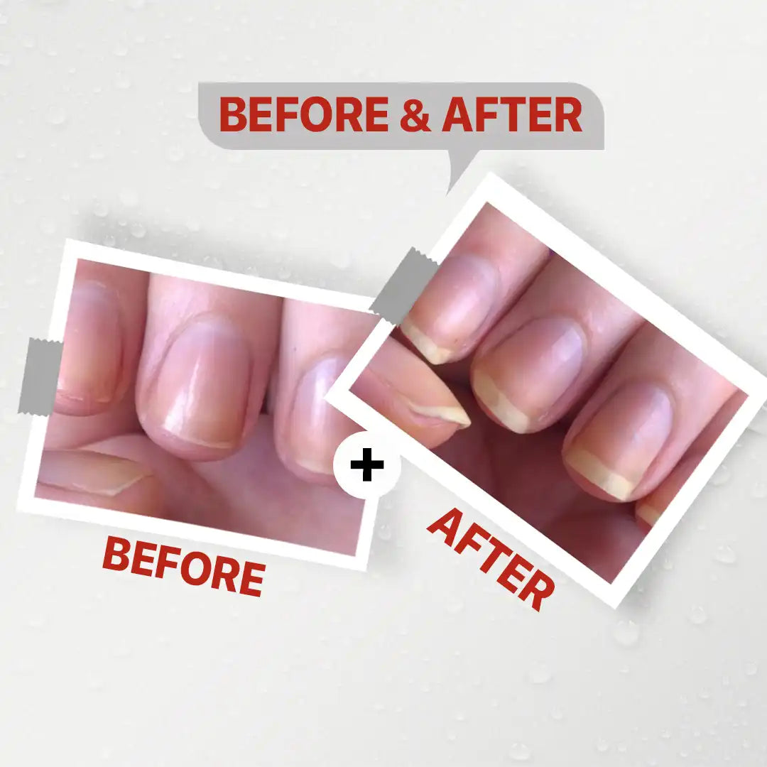 Seelit Nail Serum
