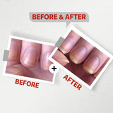 Seelit Nail Serum