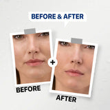 GENFX 6 PEPTIDE SKIN BOOSTER (30ml)