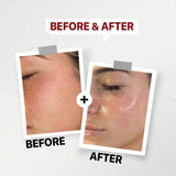 GENFX CICA CREAM GEL (50gm)