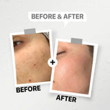 GENFX SNAIL CREAM GEL (50gm)