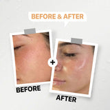 GENFX VITAMIN C SERUM 5-IN-1 (30ml)